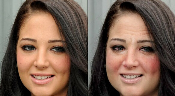 Симптомы и стадии алкогольной зависимости